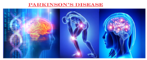 parkinson's disease